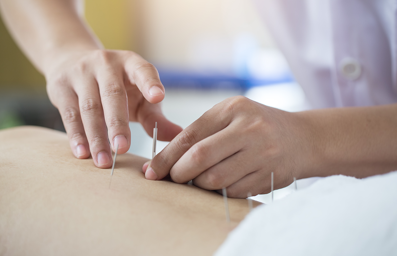 Accupuncture Colloge